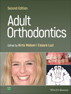 cover image of Adult Orthodontics